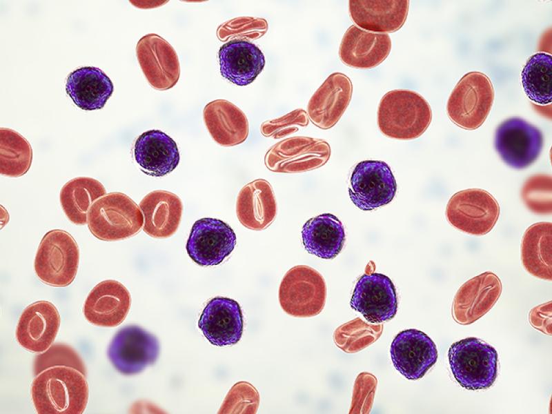 leukemia cells