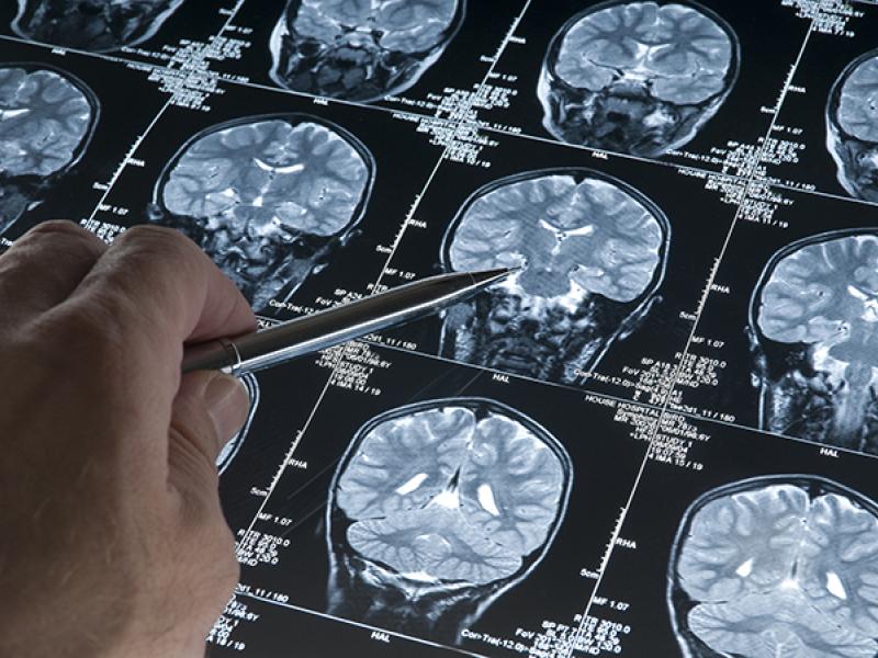 brain scans